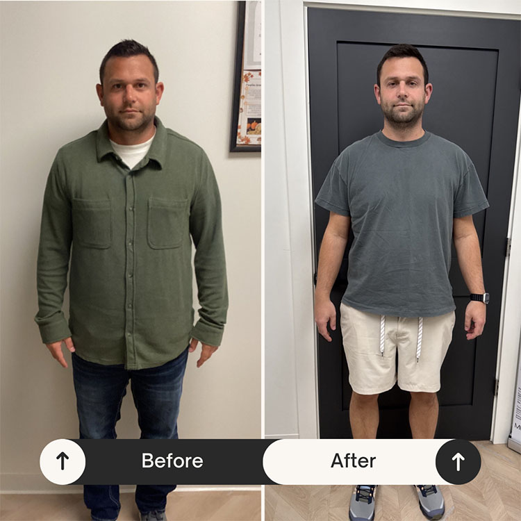 Weight Loss