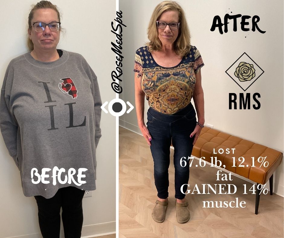 Weight Loss Before and After